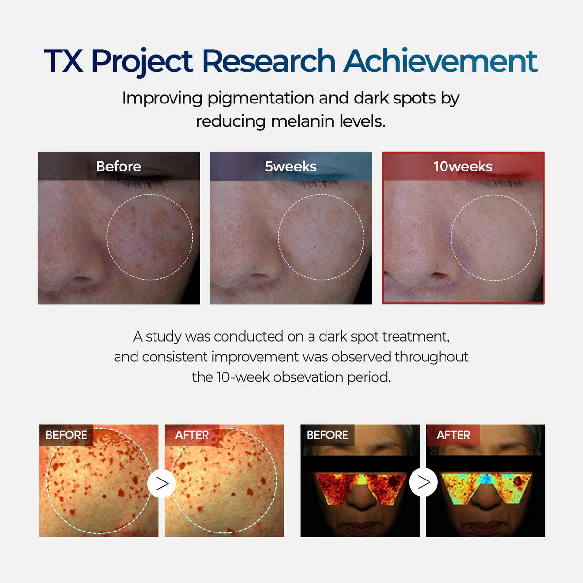 TX Ampoule Rx - image 6